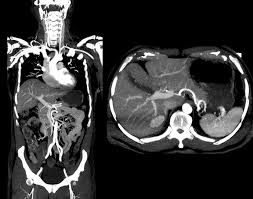 Acute CT Body Course for Radiographers